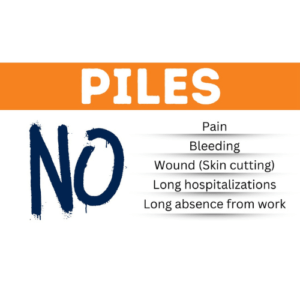 piles surgery