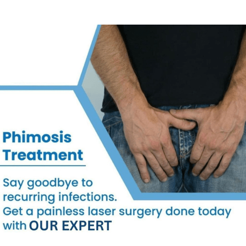 Treatment for Phimosis in Agra