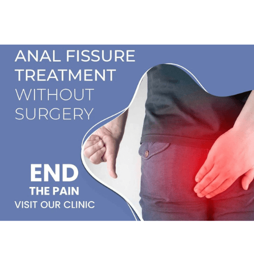 Anal Fissure Treatment