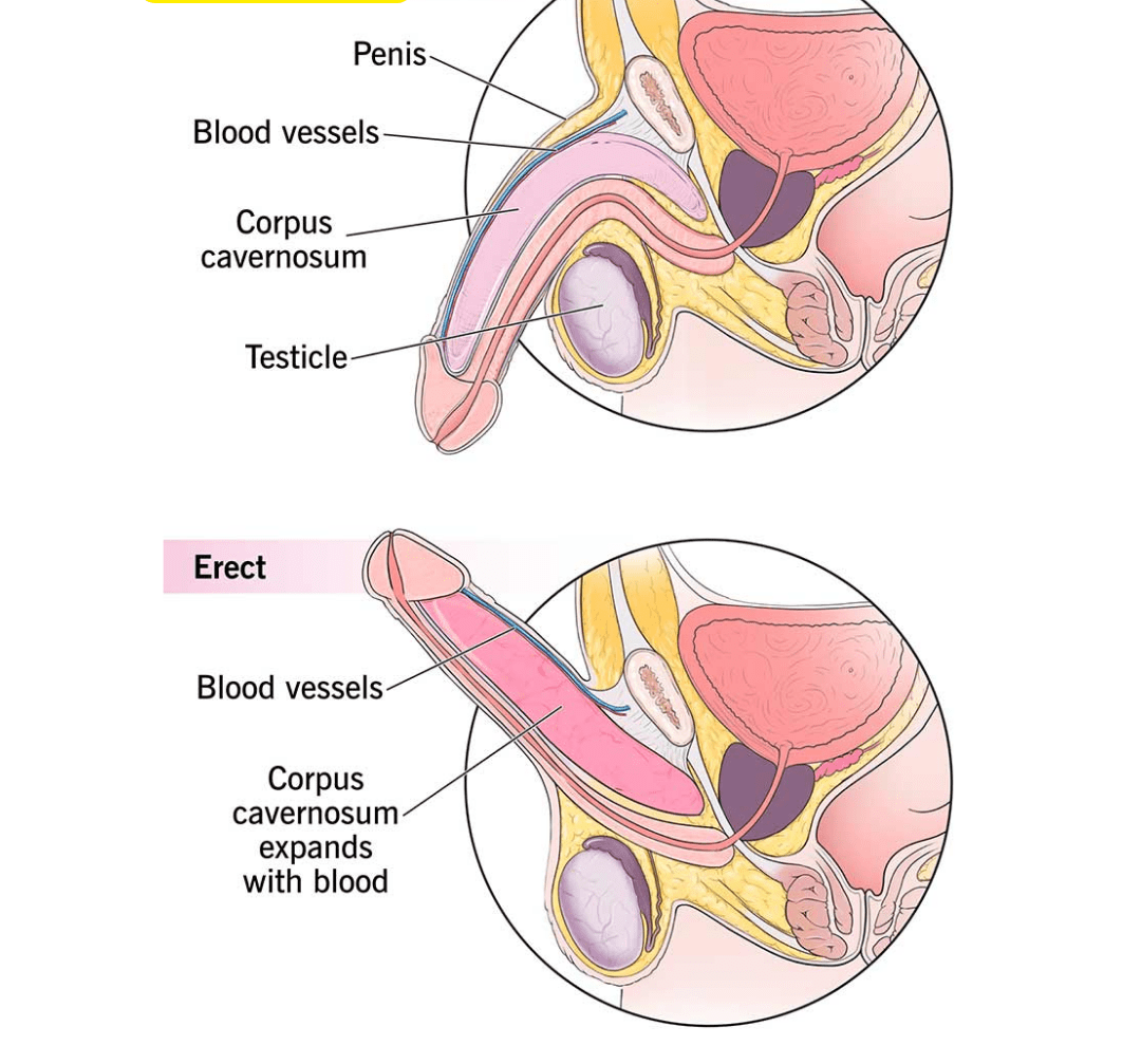 treatment for Erectile Dysfunction