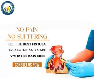 What is Anal fistula