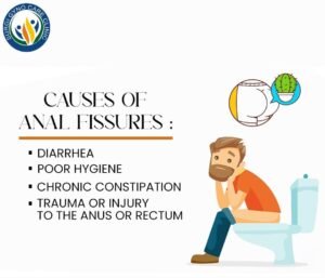 Causes of Anal fistula