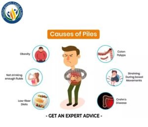 Causes of Piles