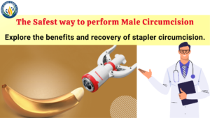 zsr circumcision, best circumcision doctor, phimosis doctor,