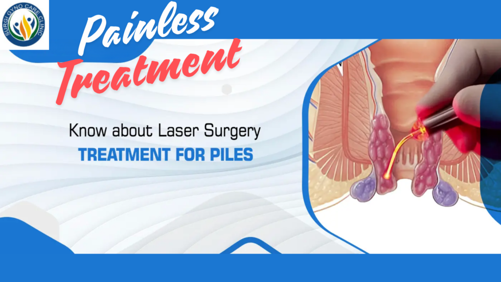 laser piles treatment in agra