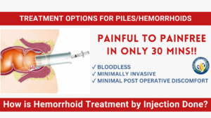 Hemorrhoid Injection Treatment vs. Laser Surgery: Best Relief Options in Agra